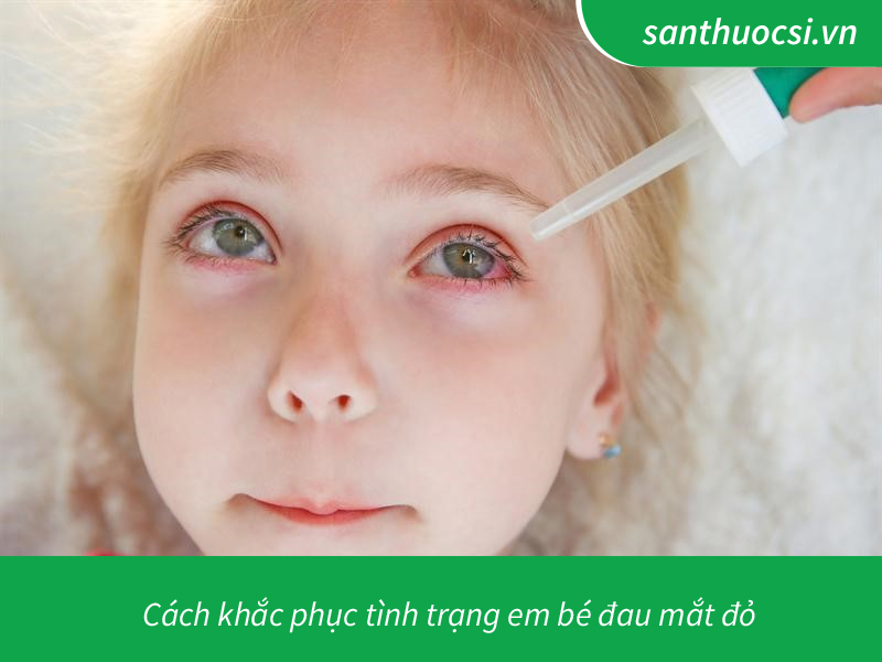 Cách khắc phục tình trạng em bé đau mắt đỏ