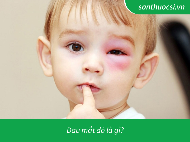 Đau mắt đỏ là gì?