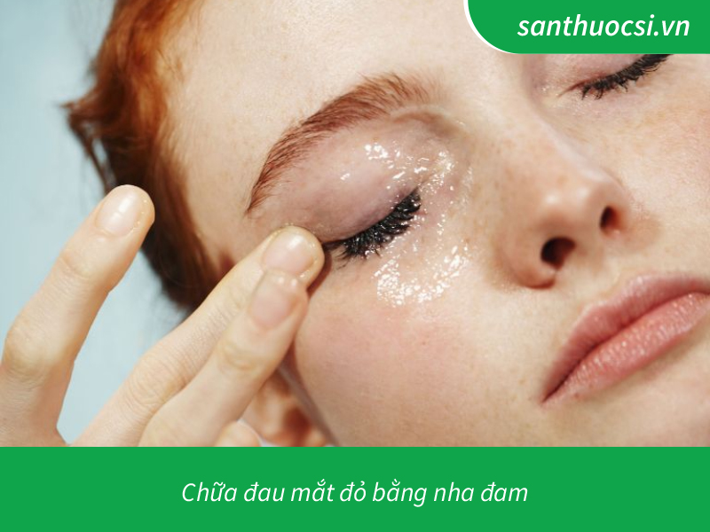 Chữa đau mắt đỏ bằng nha đam