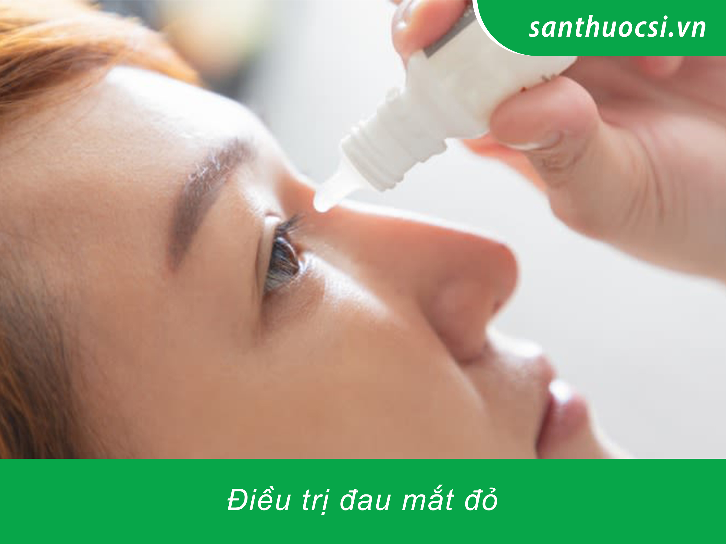 Điều trị đau mắt đỏ